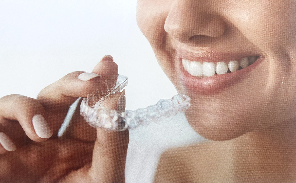 Invisalign