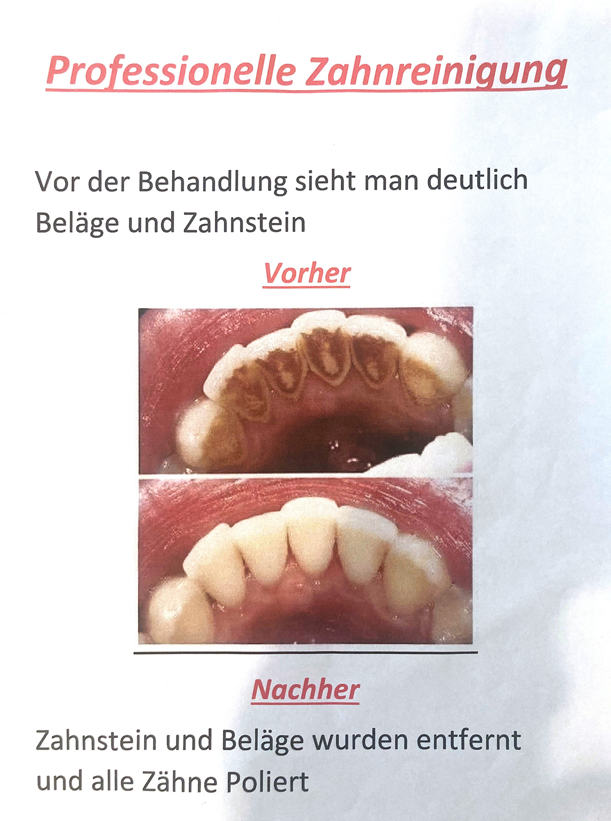 Zahnreinigung